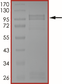 EGFR (T790M C797S), Active